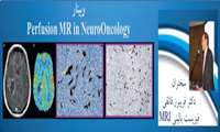 بینار  Perfusion MR in NeuroOncologyتوسط دانشکده پیراپزشکی برگزار می شود